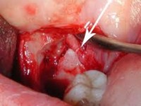 Chirurgia Orale studio odontoiatrico fiumara
