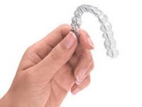 Ortodonzia tradizionale e invisalign