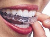 Ortodonzia tradizionale e invisalign studio odontoiatrico fiumara