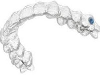 Ortodonzia tradizionale e invisalign studio odontoiatrico fiumara