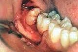 chirurgia orale studio odontoiatrico fiumara