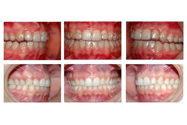 ortodonzia studio odontoiatrico fiumara