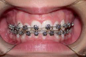 ortodonzia studio odontoiatrico fiumara