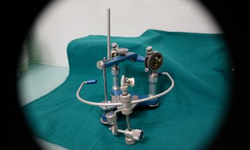 Articolatore a valori individuali per protesi totale articolatore a valori individuali per protesi totale