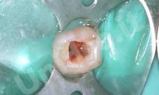 Odontoiatria conservatrice odontoiatria conservatrice studio odontoiatrico fiumara