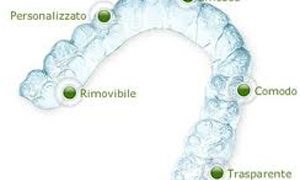 Ortodonzia tradizionale e Invisalign ortodonzia invisalign studio odontoiatrico fiumara